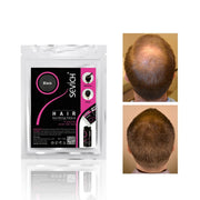 Sevich Keratin Hair Building Fibers