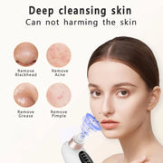 Electric Blackhead Remover Pore Vacuum