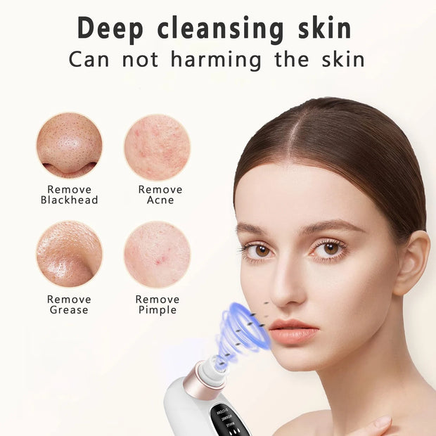 Electric Blackhead Remover Pore Vacuum