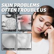 Facial Redness Repair Cream