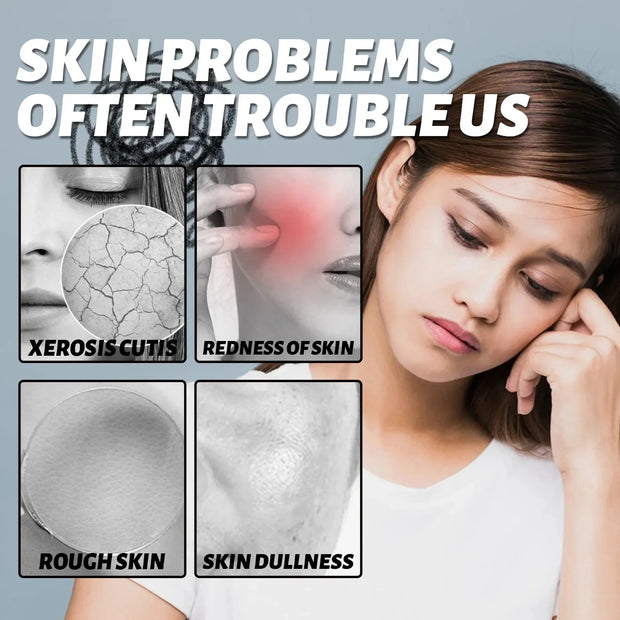 Facial Redness Repair Cream