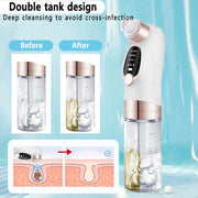 Electric Blackhead Remover Pore Vacuum