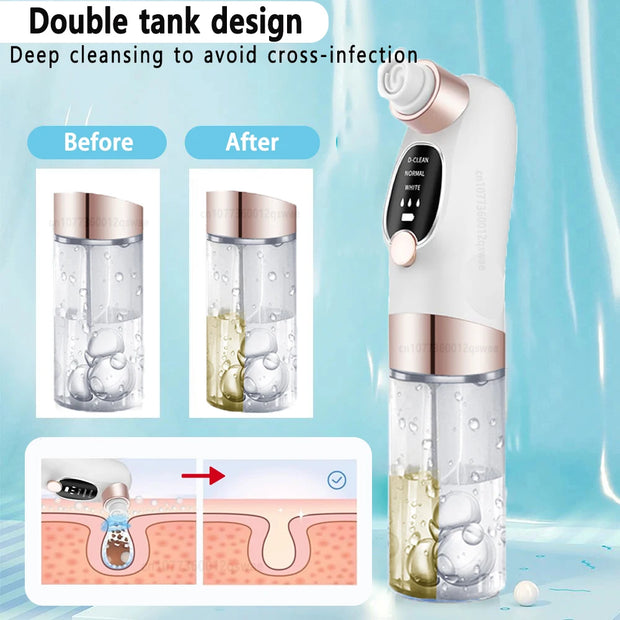 Electric Blackhead Remover Pore Vacuum