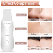 Electric Skin Scrubber