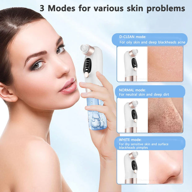 Electric Blackhead Remover Pore Vacuum