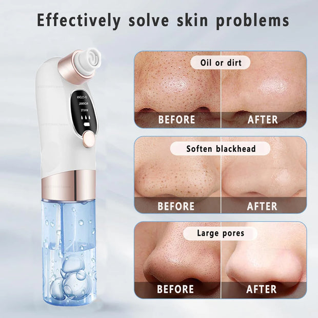 Electric Blackhead Remover Pore Vacuum