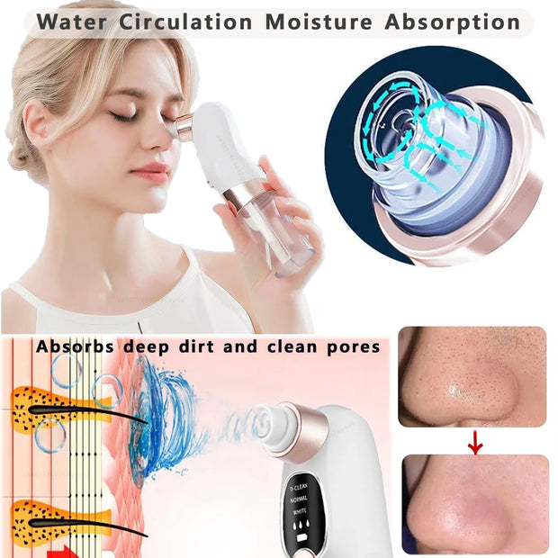 Electric Blackhead Remover Pore Vacuum